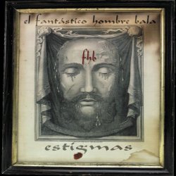   - Estigmas